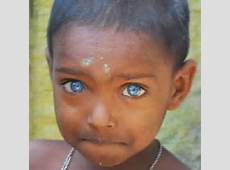 dark skin blue eyes 5